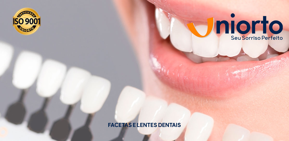 Facetas e Lentes Dentais — Uniorto Ortodontia